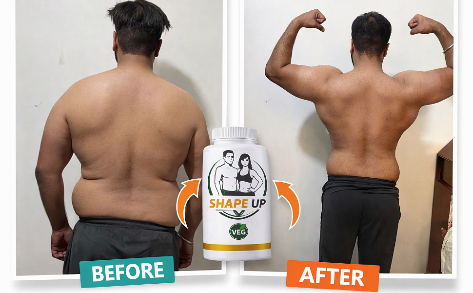 Shape Up Weight Loss Capsules | Natural Fat Burner Supplement with Acetyl L Carnitine For Men & Women | FSSAI Certified | Supports Metabolism & Reduces Cravings Appetite | 60 Veg Capsules