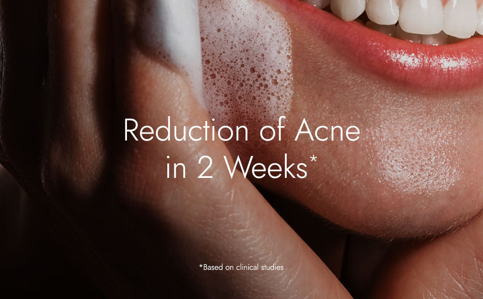 Kapiva Acne Control Tulsi Face Wash | Reduces Active Acne & Scars | For All Skin Types | 0% Parabens, Sulfates, Silicones