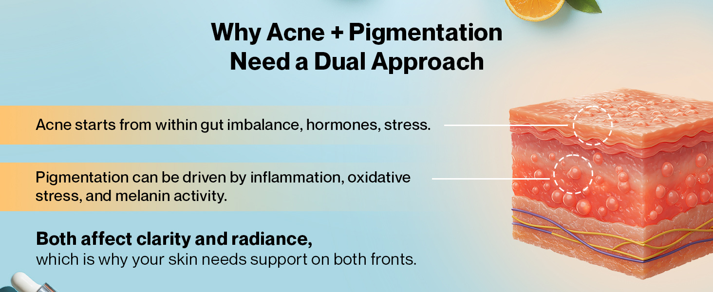 Setu Clear Skin Combo - Skin: AcneClear (150g) + Skin: Renew Glutathione Fizz (30 Tablets) for Skin Glow (BIFIACNEL® Probiotic & Detox Formula) | Targets Hormonal Acne, Gut Inflammation & Dark Spots | 30 days pack