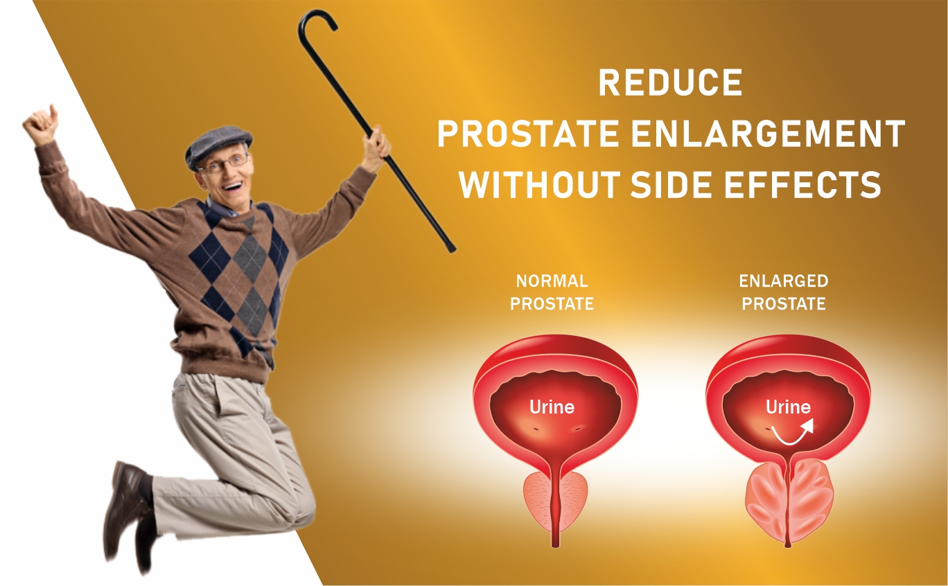 Prostate Capsules | 10 Herbal Ingredients | Gokshura & Lajjalu | Prostate Enlargement, Supports BPH, Urinary Flow & Bladder Health | Reduces Inflammation & Burning |30 Capsules