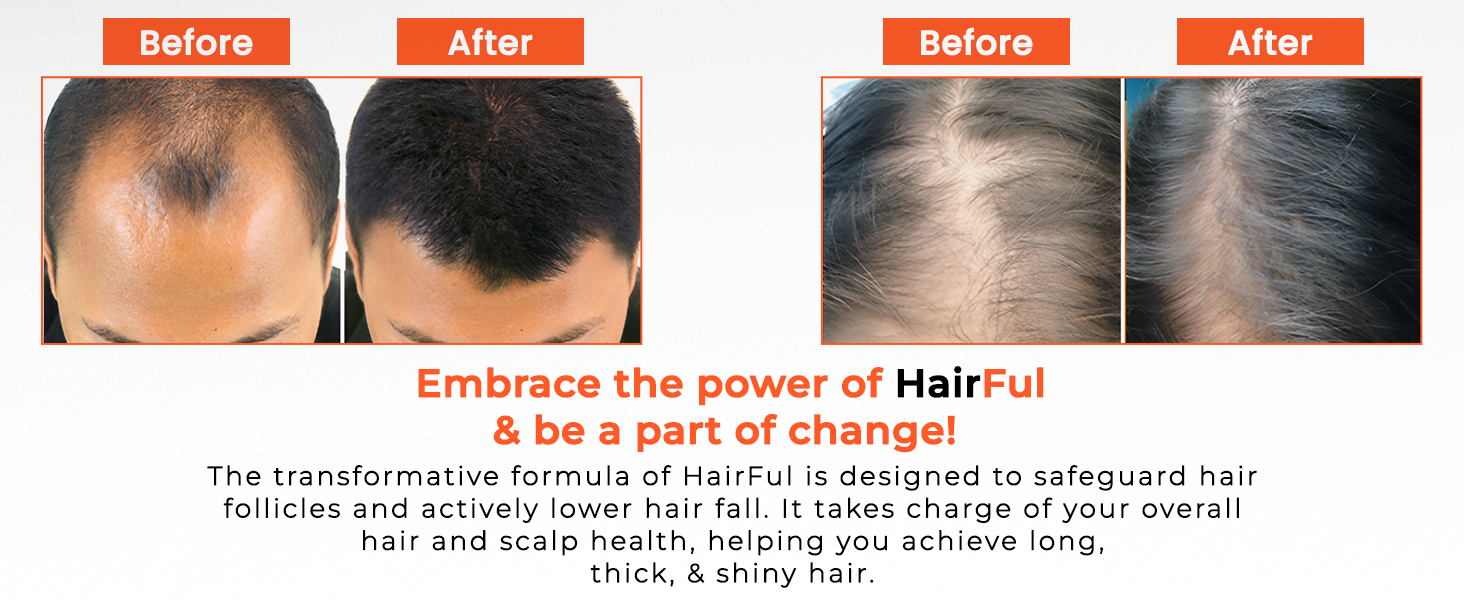 HairFul Biotin Tablets for Hair Growth & Hair Fall Control – 100% Natural Hair Vitamin Supplement with Biotin for Women & Men – 30 Tablets (Pack of 2)