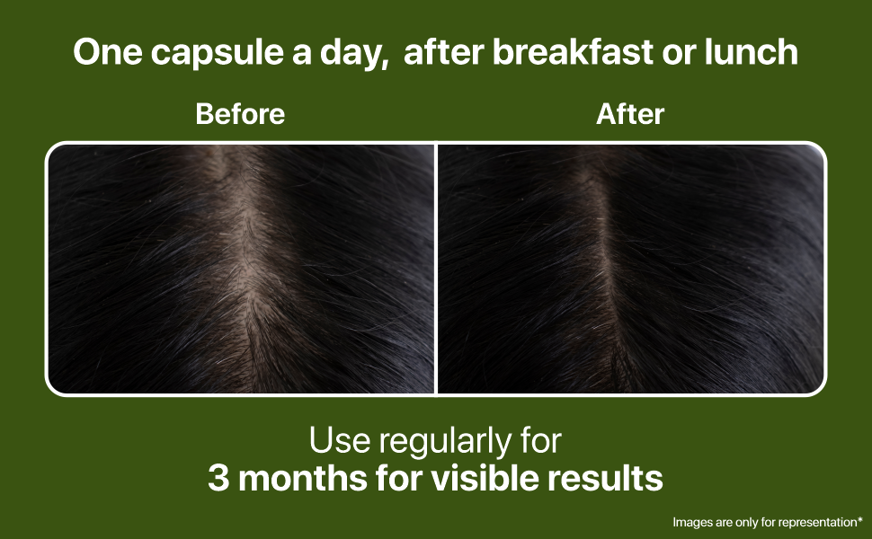 Nature’s Island Hair Vitamins Capsules for Hair Growth & Hair Fall Control, Natural DHT Blocker & Biotin Capsules for Men & Women, Contains Biotin, Folic Acid, Zinc, Iron, Korean Ginseng, Vitamin A to E, Amino Acids, Selenium, Copper, 60 Days Pack