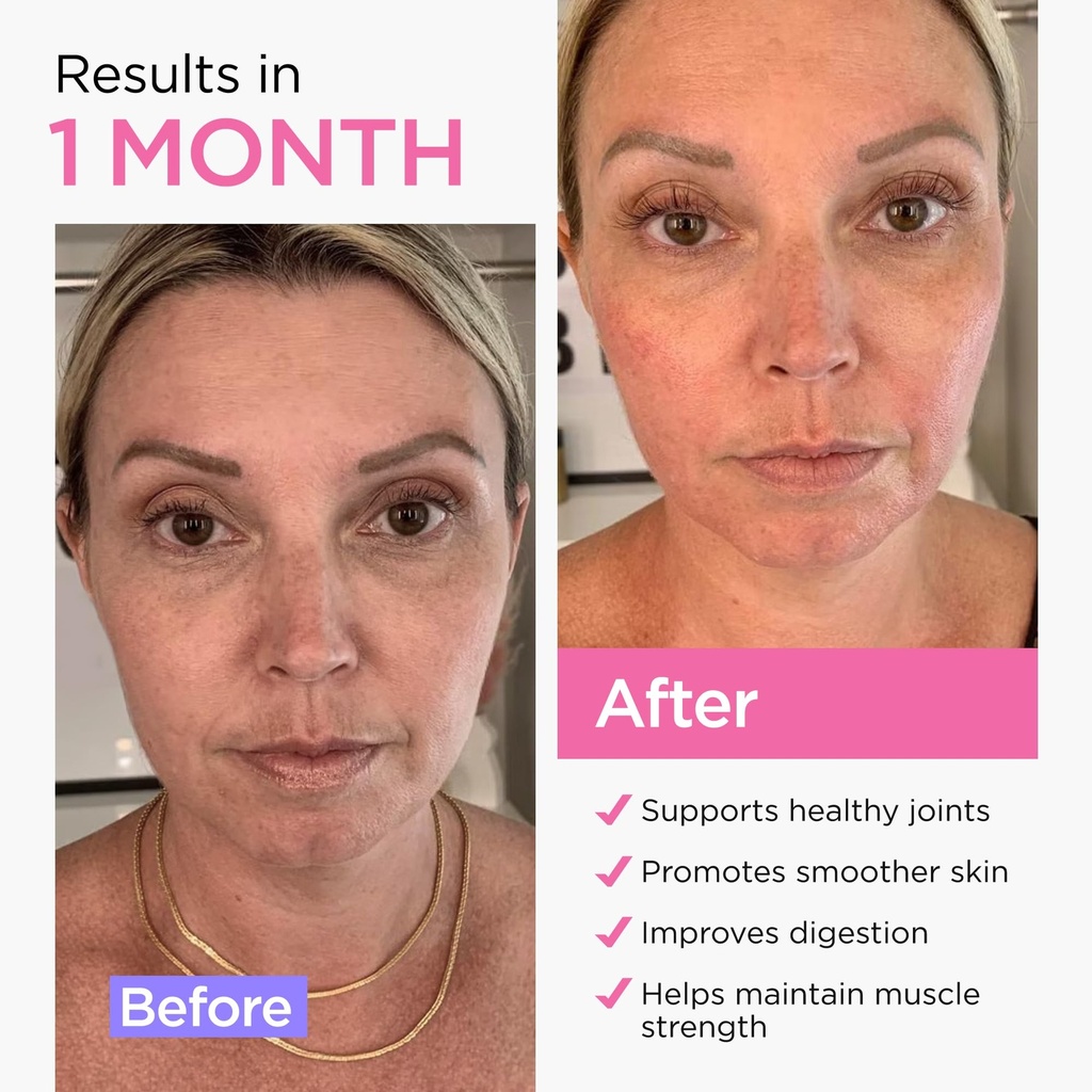 collagen-peptides-powder-for-women-hydro-2.jpg