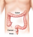 miracle-oxy-colon-cleanse-vegan-colon-cl-6.jpg