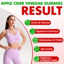 apple-cider-vinegar-gummies-advanced-acv-2.jpg