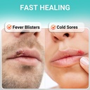 ishancare-cold-sore-treatment-cream-fast-2.jpg