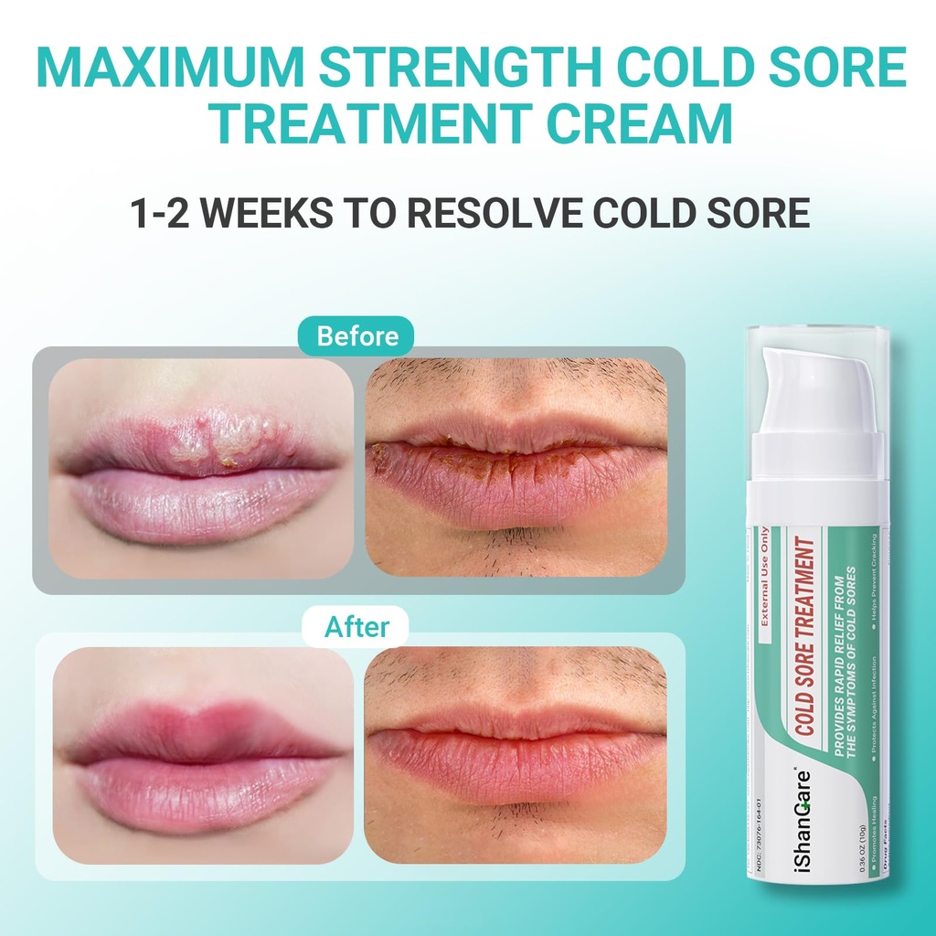 ishancare-cold-sore-treatment-cream-fast-5.jpg