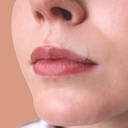 smart-cold-sore-treatment-patch-with-lem-3.jpg