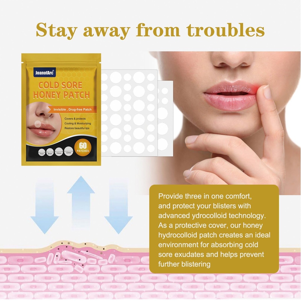joanofarc-cold-sore-honey-patches-fast-r-3.jpg