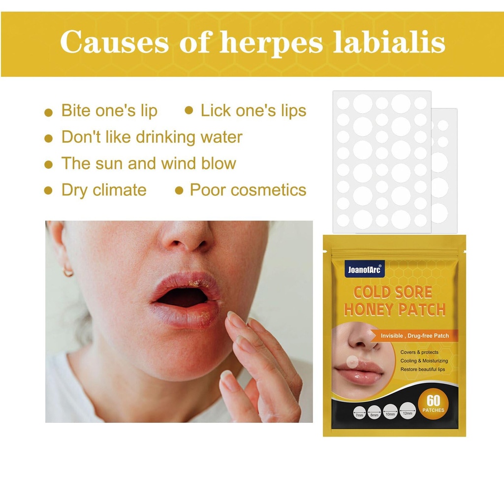 joanofarc-cold-sore-honey-patches-fast-r-5.jpg