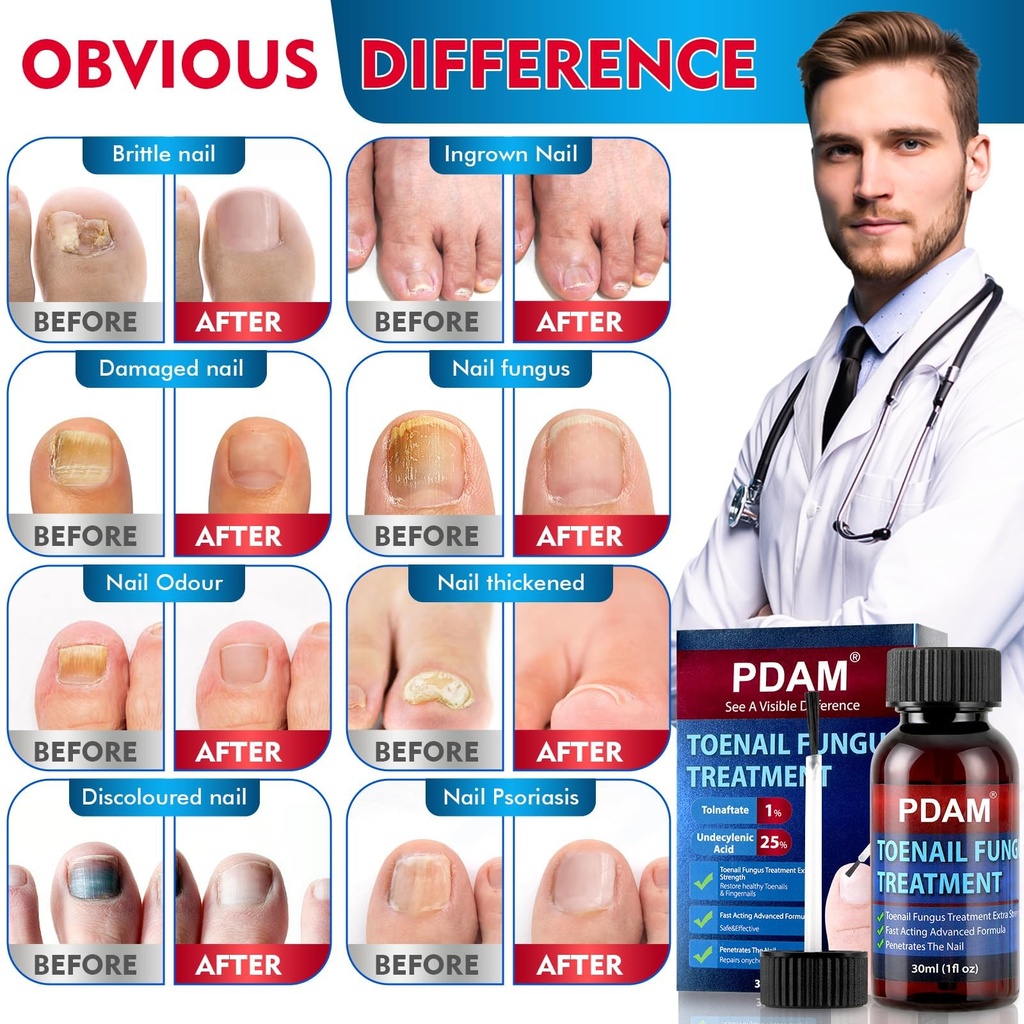 toenail-fungus-treatment-extra-strength--3.jpg