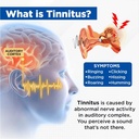 acupeace-tinnitus-relief-device-auricalm-2.jpg