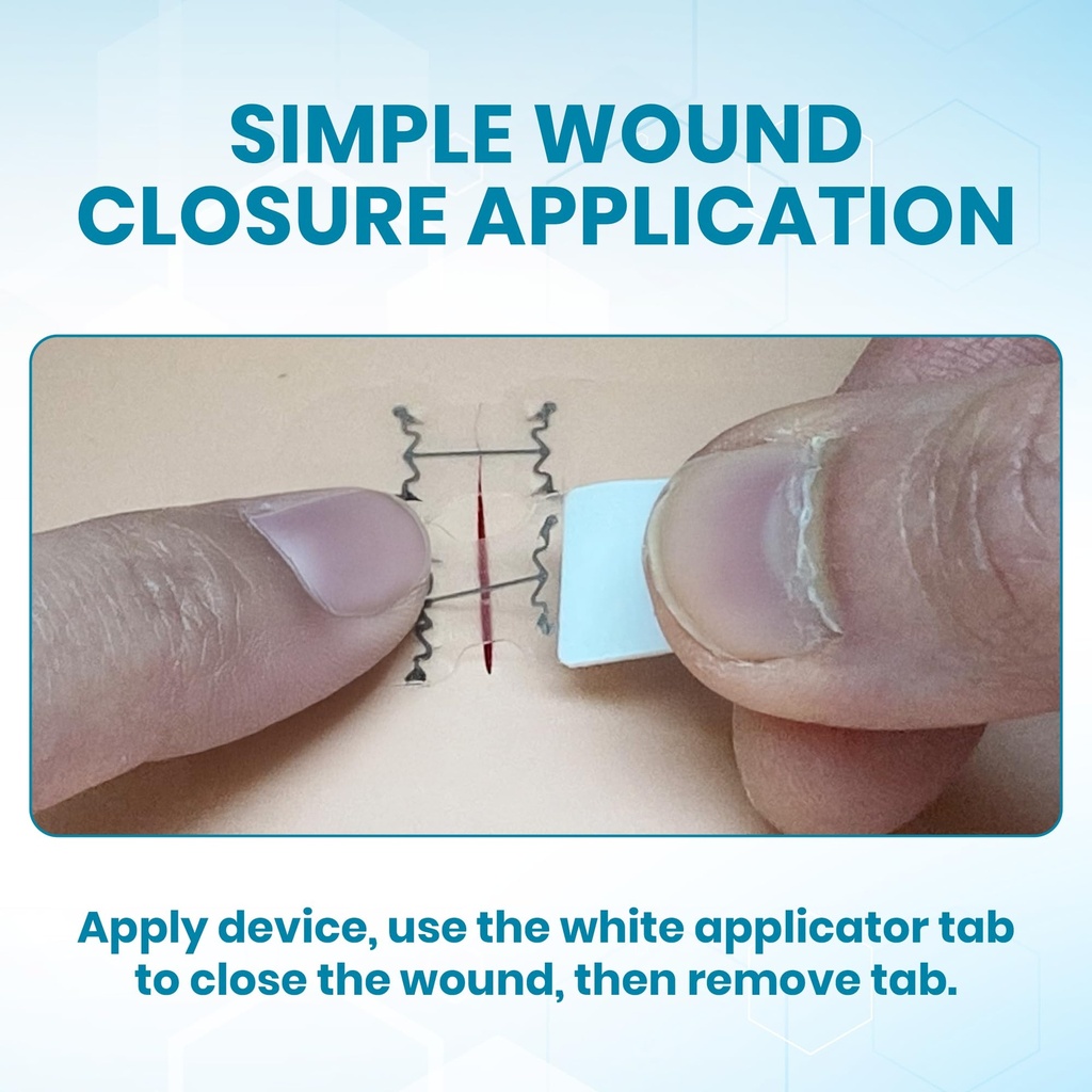 emergency-wound-closure-kit-6-sterile-la-6.jpg
