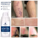100-silicone-scar-gel-2-pack-2-x-1-06oz--71+EmVpixeL.jpg