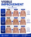 toenail-fungus-treatment-25-undecylenic--71P1yjjYYEL.jpg