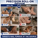 toenail-fungus-treatment-25-undecylenic--81FgcjTwpmL.jpg