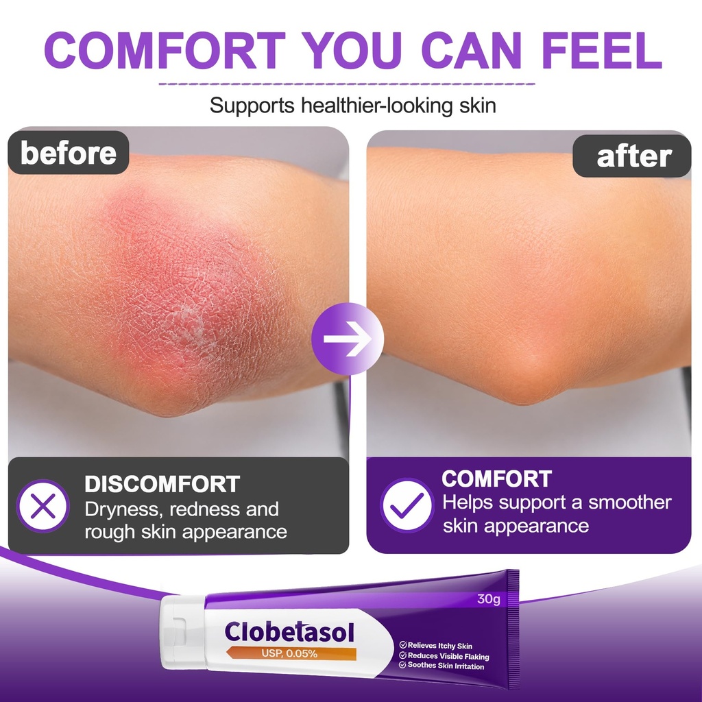 cream-0-05-formula-for-skin-comfort-supp-81Bmer59QjL.jpg