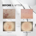 vt-cosmetics-reedle-shot-300-stick-2ml-x-616J4h3GzxL.jpg