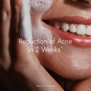 kapiva-acne-control-tulsi-face-wash-redu-714b5o1fbDL.jpg