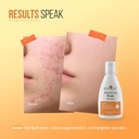 the-element-manjistha-brightening-drops--71dek+lgG9L.jpg