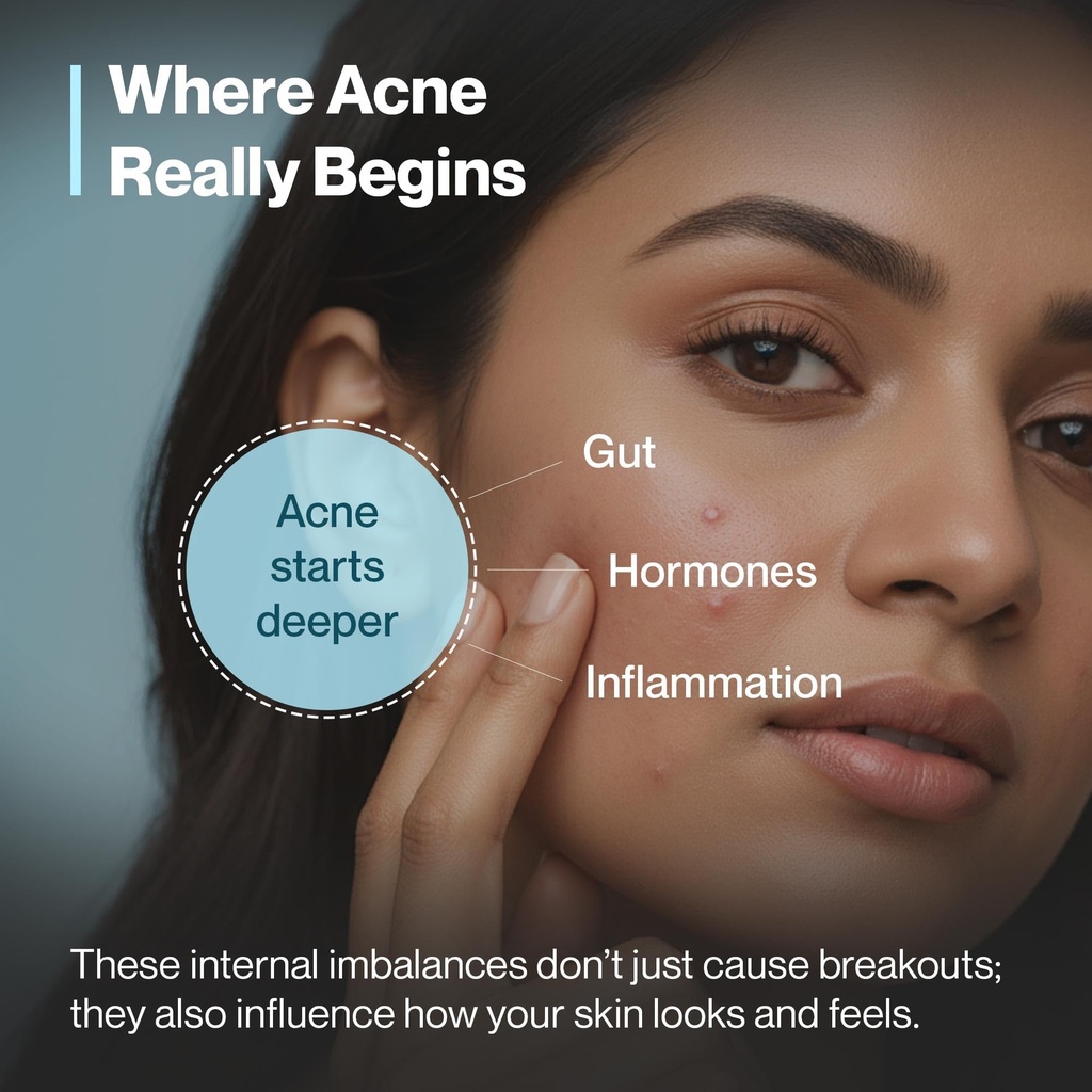 setu-clear-skin-combo-skin-acneclear-150-71FE6pedDeL.jpg
