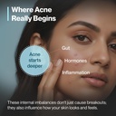 setu-clear-skin-combo-skin-acneclear-150-71FE6pedDeL.jpg
