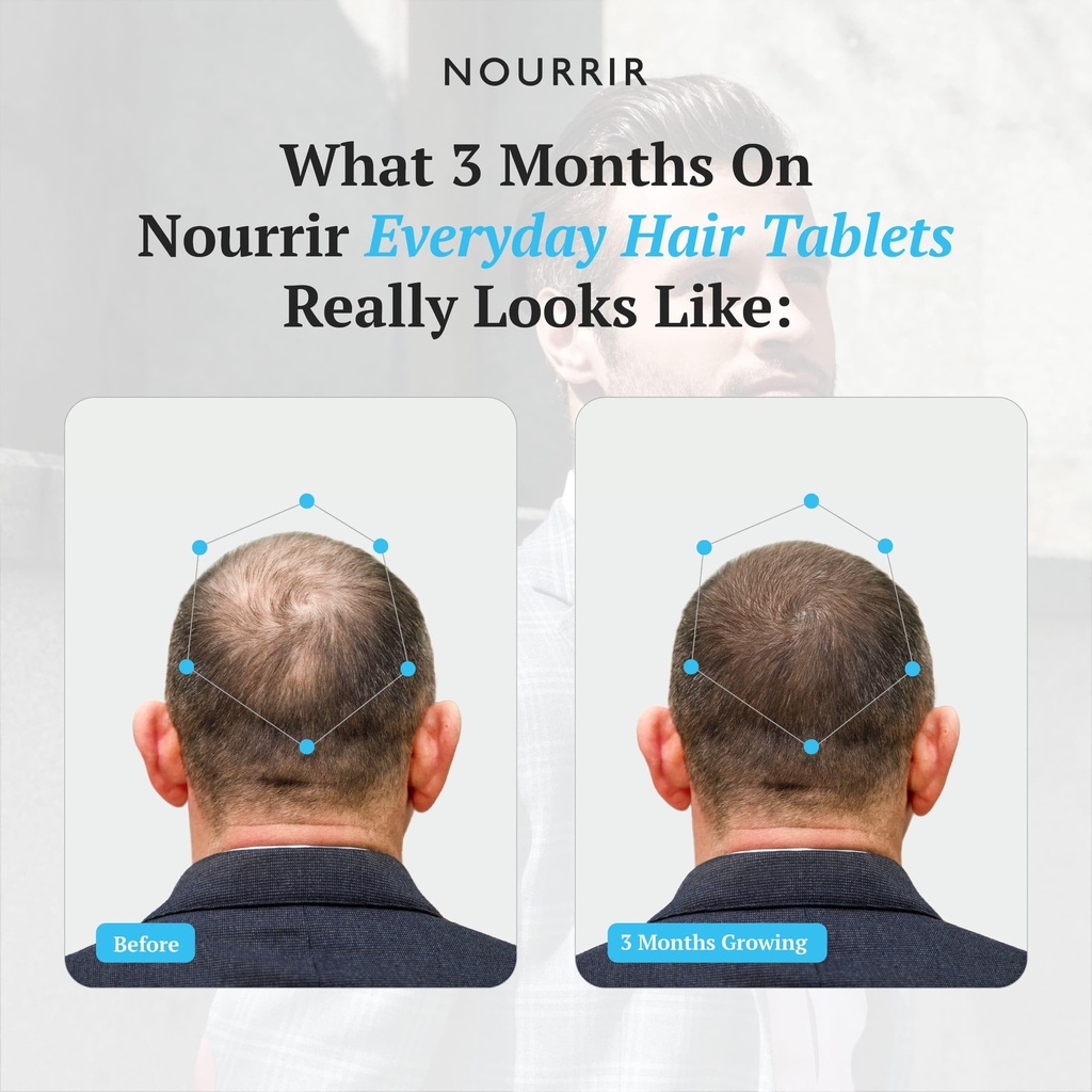 men-s-hair-growth-tablets-biotin-dht-blo-81x37-eH8RL.jpg