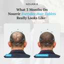 men-s-hair-growth-tablets-biotin-dht-blo-81x37-eH8RL.jpg