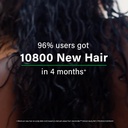 oziva-hair-vitamins-hair-growth-hair-fal-61eQeHwTDtL.jpg