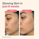 the-good-bug-gluta-glow-effervescent-tab-61ogBIdVo-L.jpg