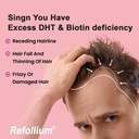 refollium-hair-vitamins-with-dht-blocker-71xer1L-TqL.jpg