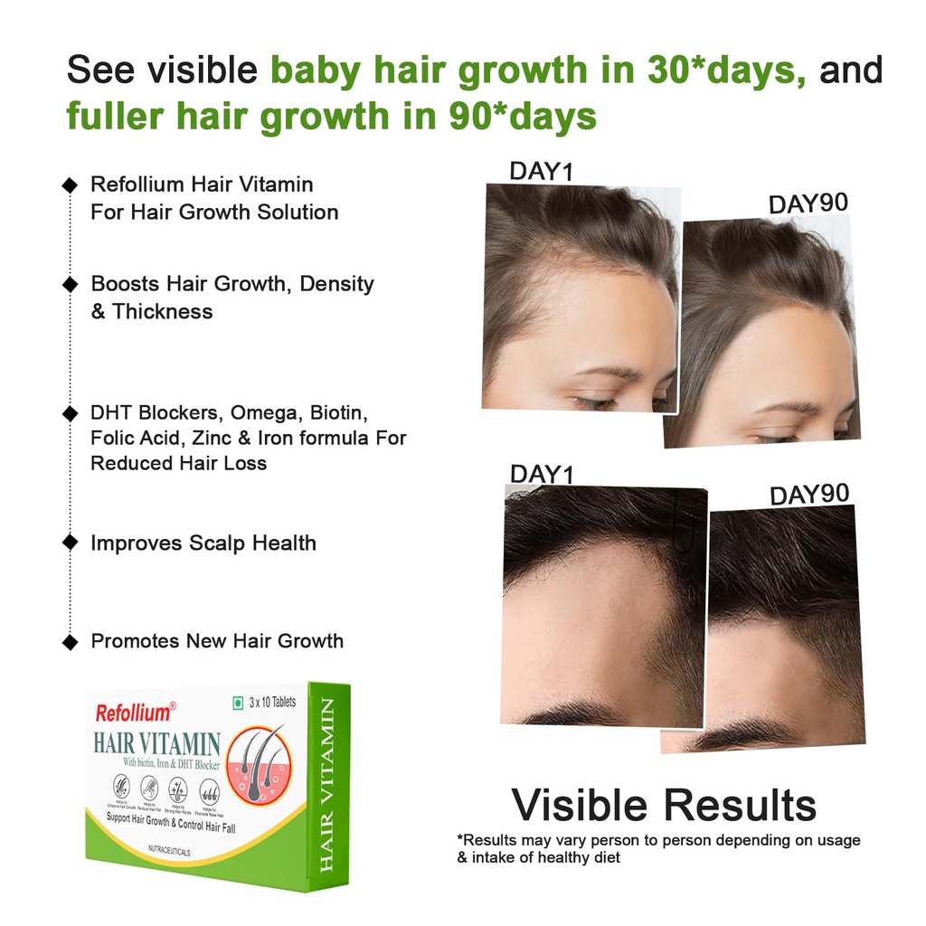 refollium-hair-vitamins-with-dht-blocker-71CfSSdYHJL.jpg