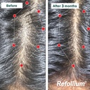 refollium-hair-vitamin-tablets-with-biot-71d8aXvrfoL.jpg