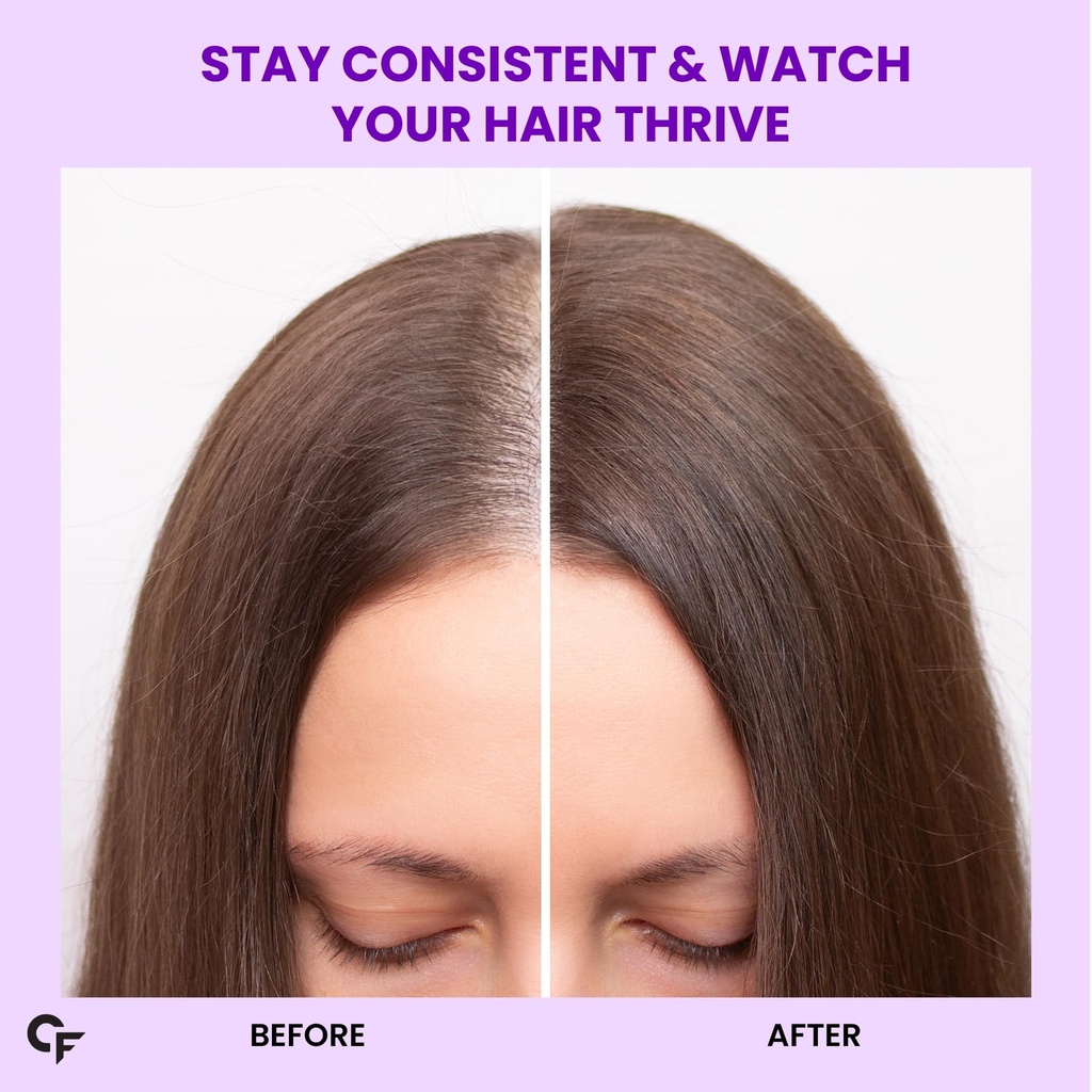 carbamide-forte-biotin-tablets-for-hair--81AGrR7w7oL.jpg