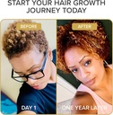 shedavi-iconic-natural-hair-vitamins-for-3.jpg
