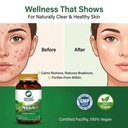 organic-wellness-neem-ayurvedic-capsules-81HoZiYphLL.jpg