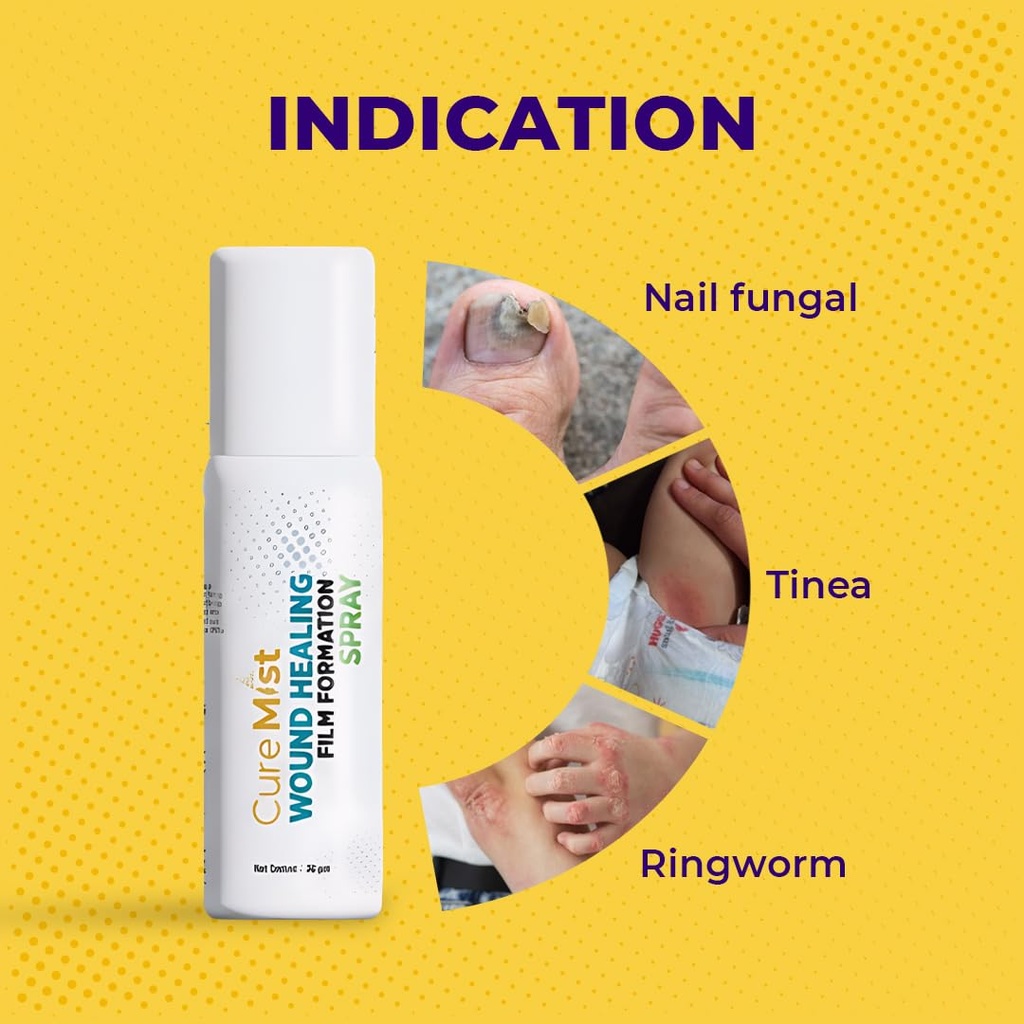 ayurvedic-first-aid-wound-spray-antisept-61aWC4SPPOL.jpg