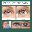 eyes-optifusion-drops-nano-drop-gentle-d-71YbZkOjTFL.jpg