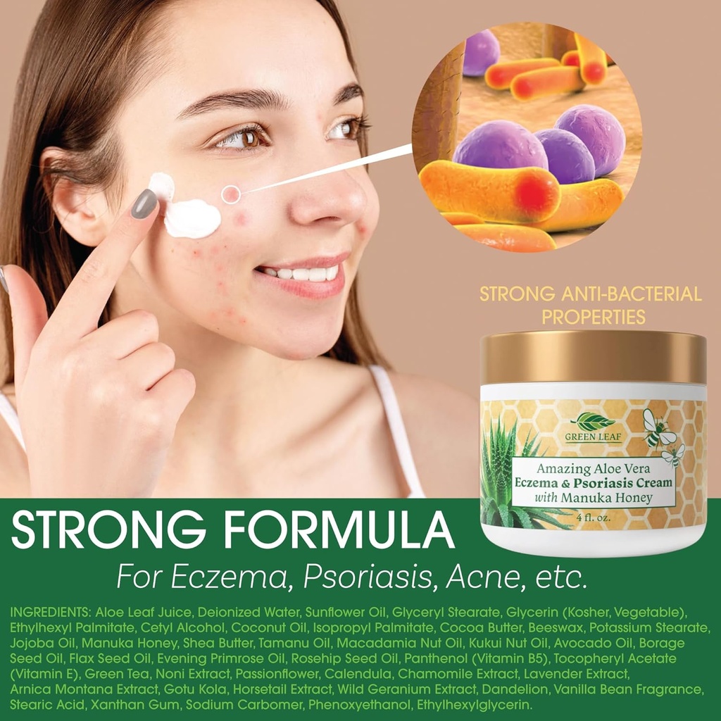 manuka-honey-eczema-cream-moisturizing-l-2.jpg