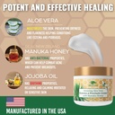 manuka-honey-eczema-cream-moisturizing-l-3.jpg