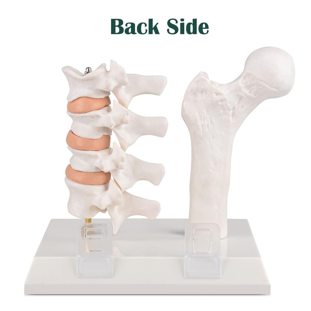 ultrassist-human-anatomy-osteoporosis-mo-4.jpg