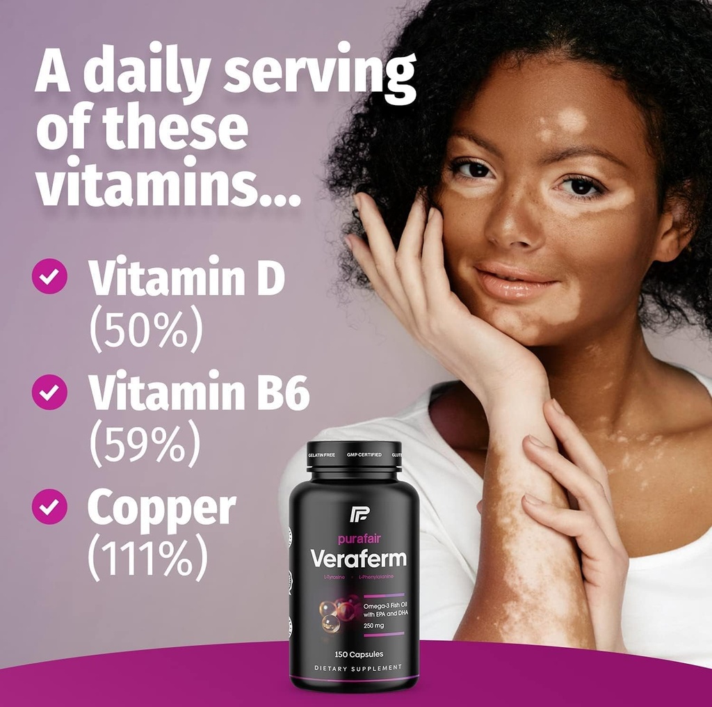 vitiligo-improve-skin-pigmentation-get-r-5.jpg