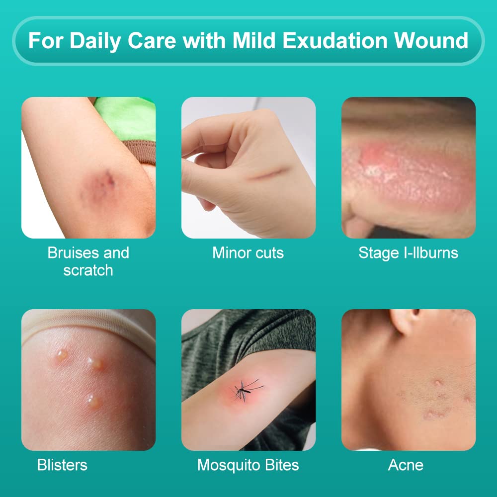 dimora-hydrocolloid-wound-dressing-silic-5.jpg