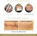 embrace-active-scar-defense-for-new-tumm-4.jpg