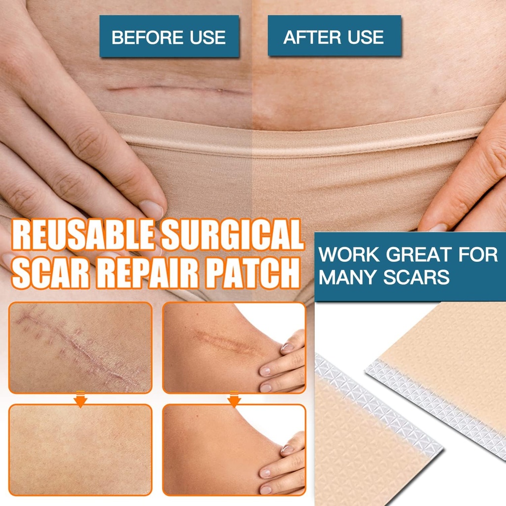 silicone-scar-sheets-2-rolls-medical-gra-4.jpg