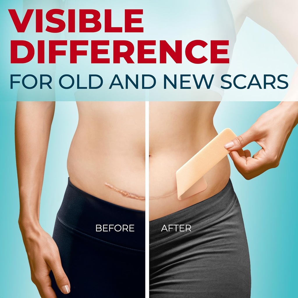medical-grade-silicone-scar-sheets---6pk-2.jpg
