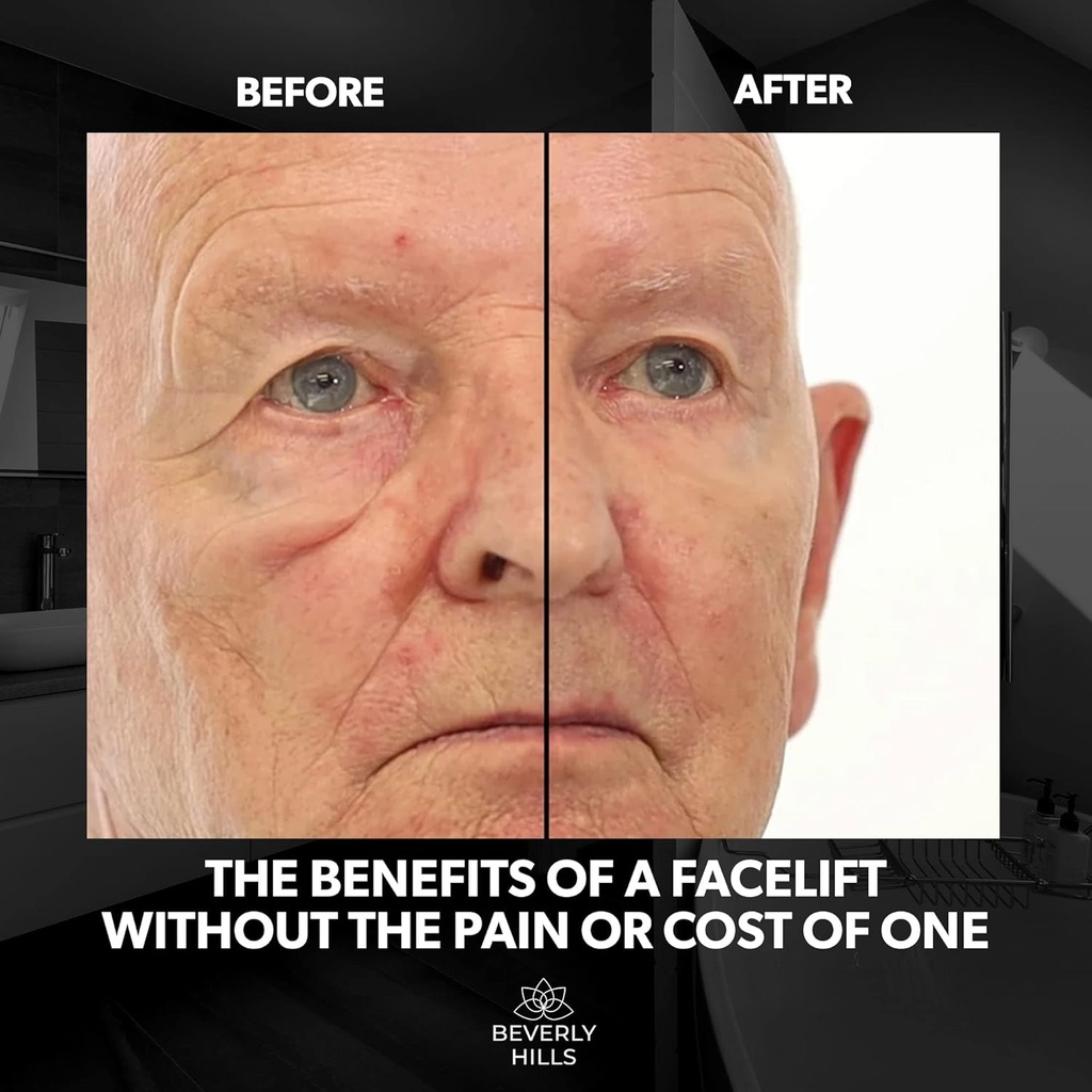 beverly-hills-mens-instant-facelift-and--3.jpg