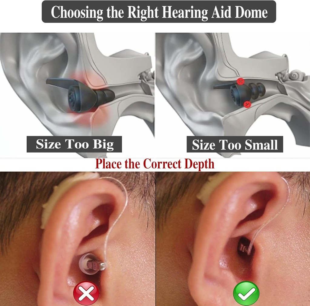 6packs-starkey-hearing-aid-domes-open-ot-5.jpg