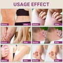 anti-itch-cream-extra-strength-anti-itch-6.jpg