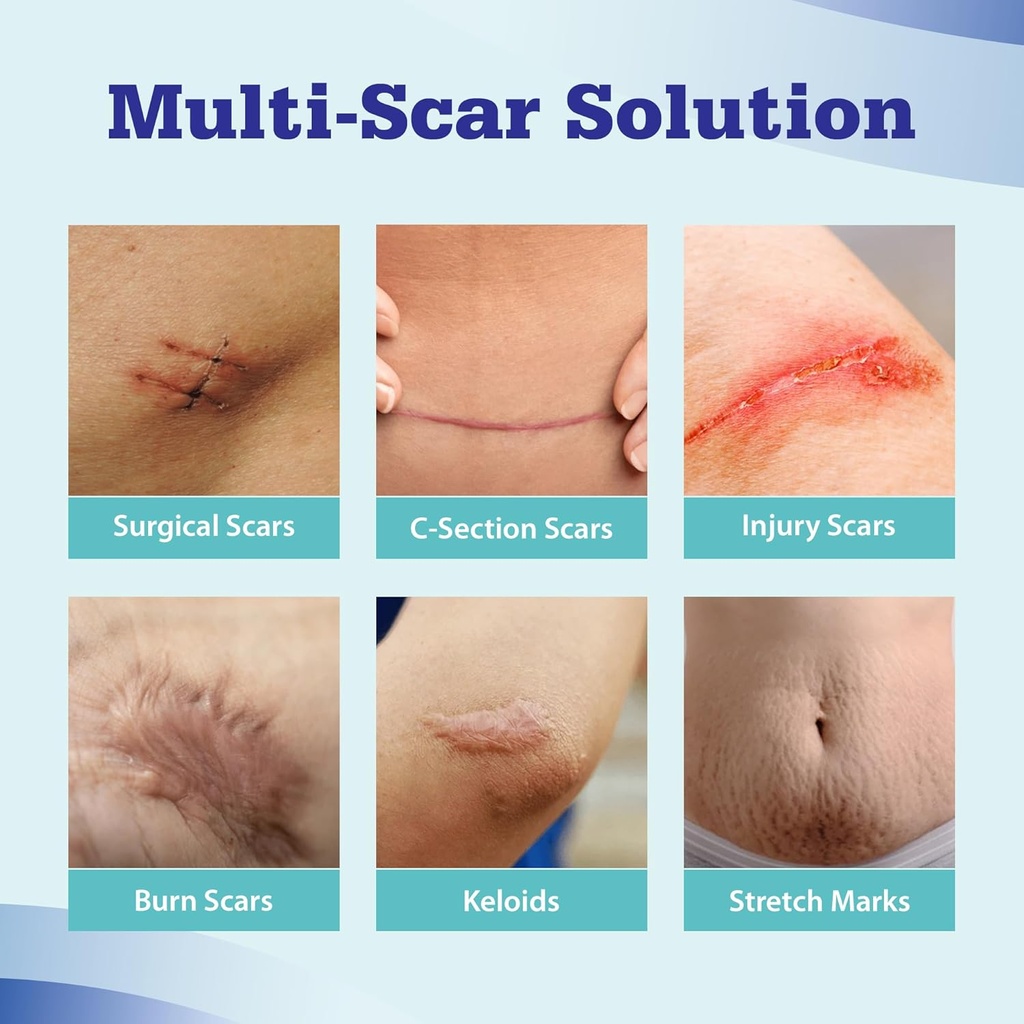 aroamas-scar-advanced-scar-gel---medical-2.jpg